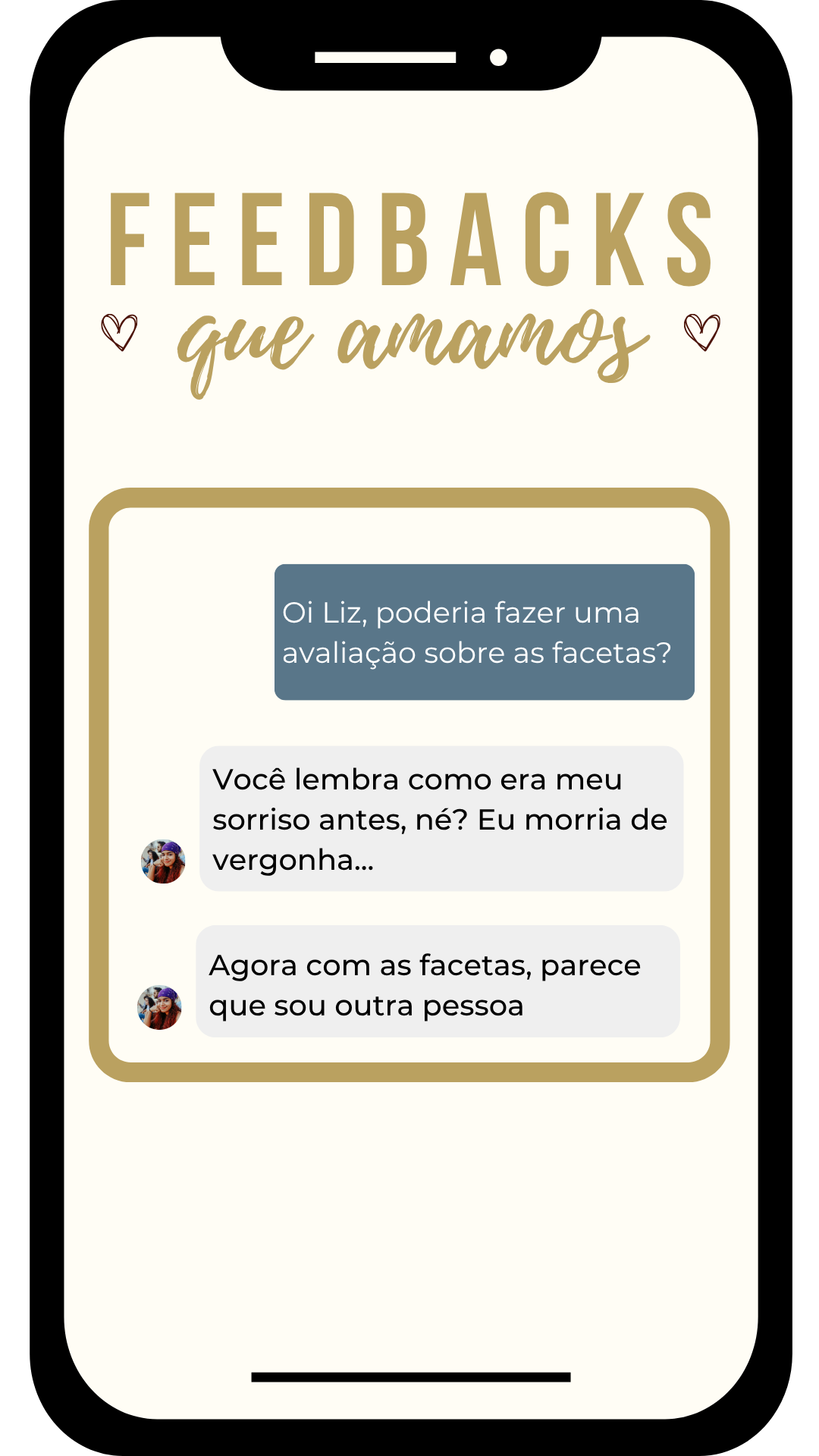 Depoimento de paciente satisfeita com lentes de resina em Sorocaba